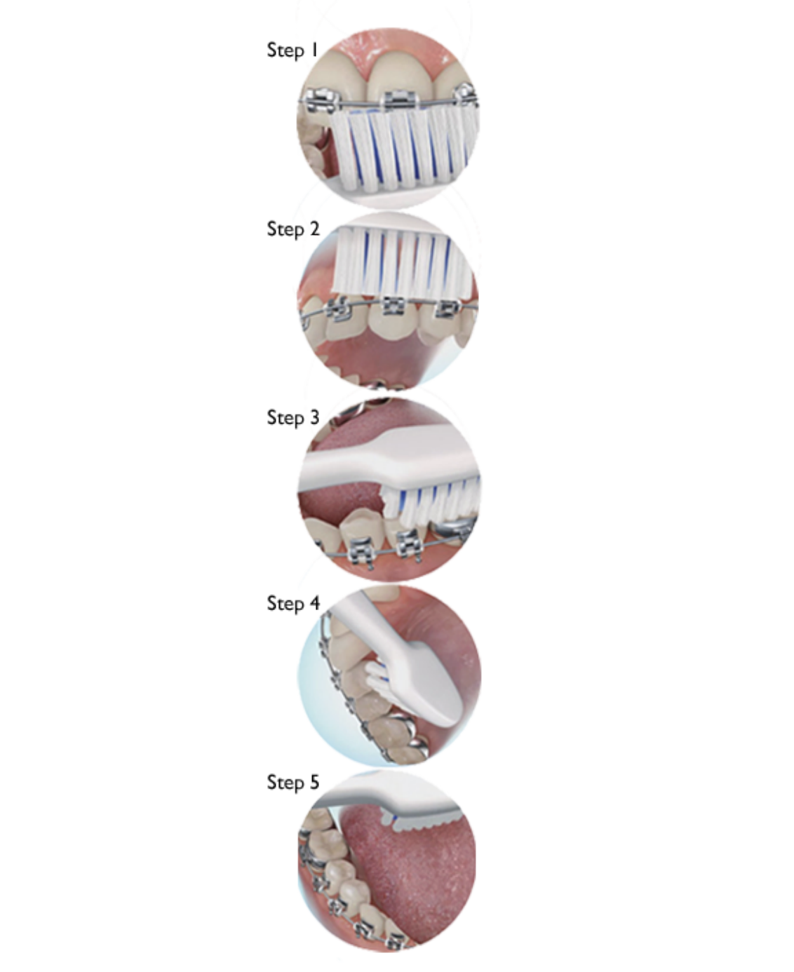 Steps for brushing